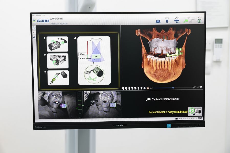 Implant planning software on screen in the surgery