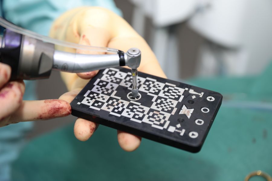 Navigated implant drilling with the X-Guide tracker