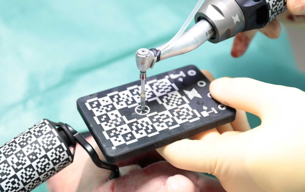 Dr Eric Battista during navigated implant surgery, one of the treatments he provides