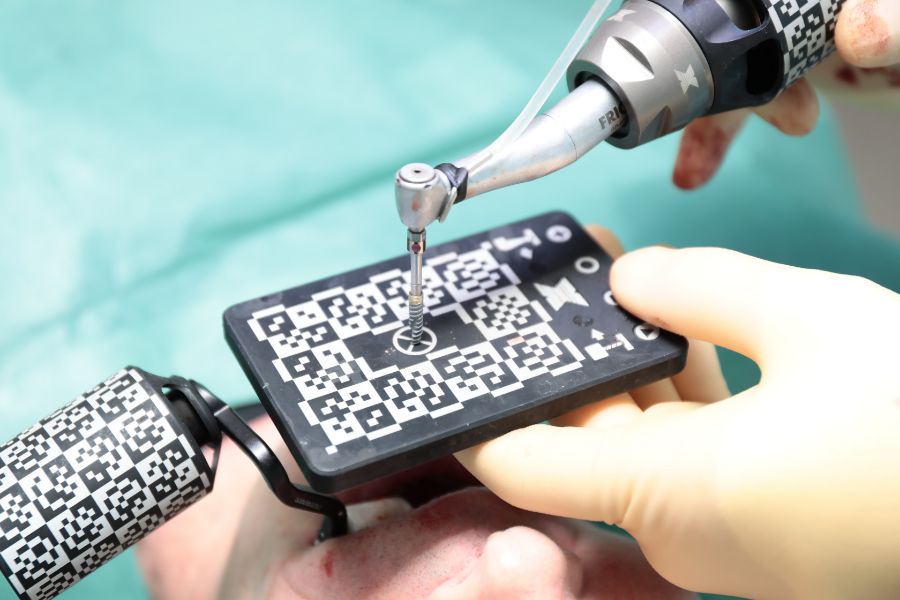 X-Guide dynamic navigation handpiece tracker